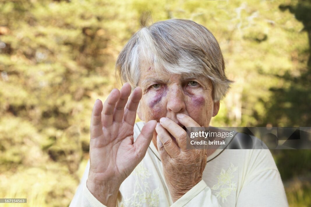 Scared and maltreated senior woman with big bruises